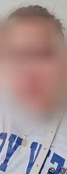Anna, 35